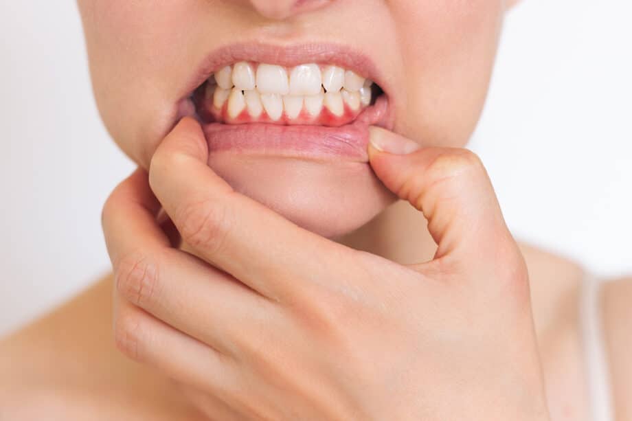 Can You Have Gum Disease Without Symptoms? How Saliva Testing Helps Identify Hidden Risks