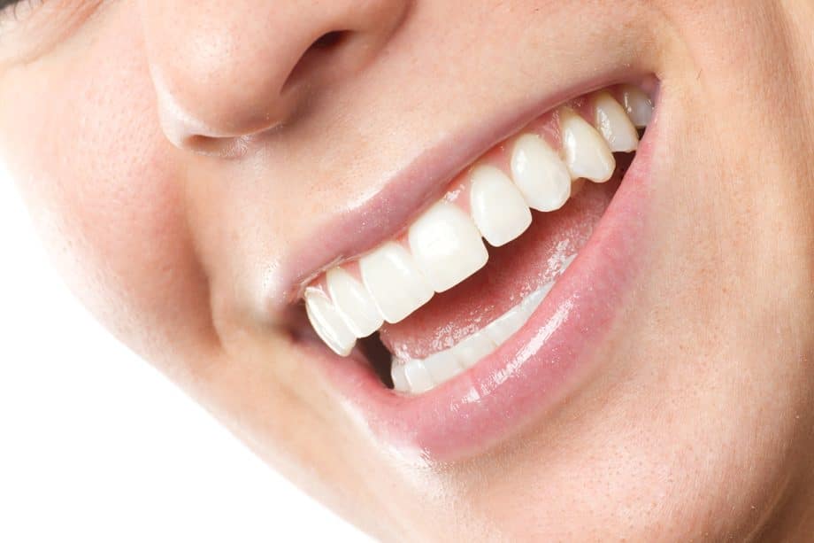 How Much Do Veneers Cost in Ellicott City, MD?